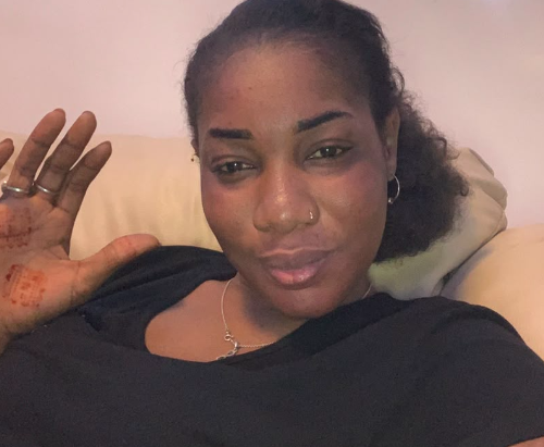 Lobé DIALLO